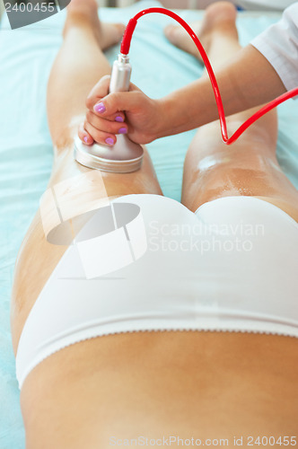Image of procedure