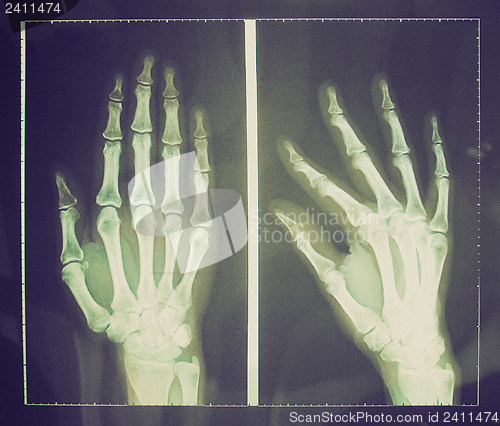 Image of Retro look Xray