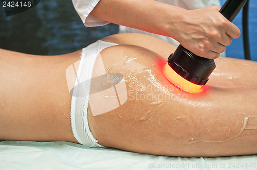 Image of procedure
