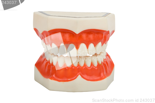 Image of dentures, dental prosthesis