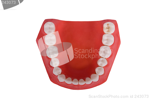 Image of dentures, dental prosthesis