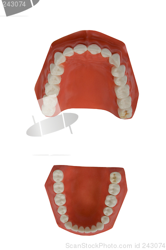 Image of dentures, dental prosthesis