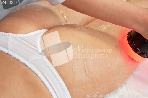 Image of procedure