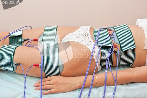Image of procedure