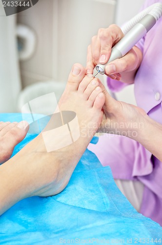 Image of foot procedure