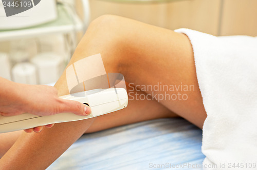 Image of laser epilation