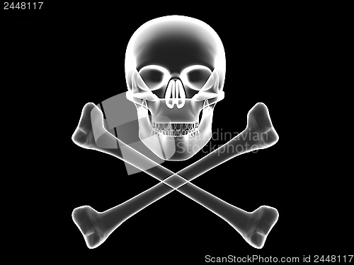 Image of Skull and crossbones x-ray silhouette