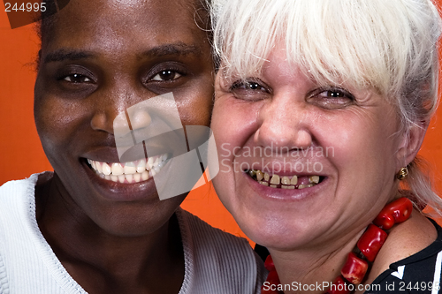 Image of Dentistry interracial couple