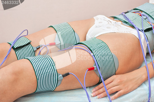 Image of procedure