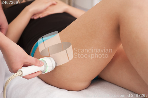 Image of procedure