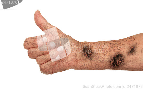 Image of Old arm with cracks and rust, concept of getting old, giving the