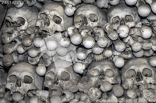 Image of Human bones.