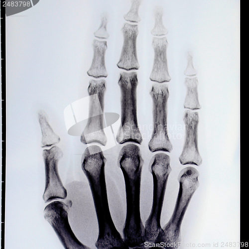 Image of Xray