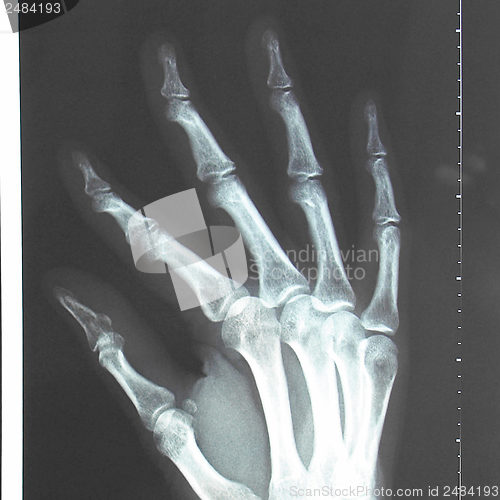 Image of Xray