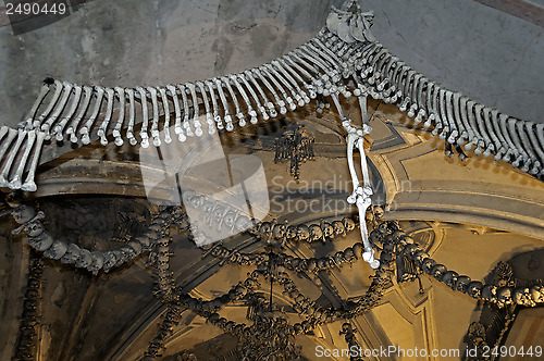 Image of Human bones.