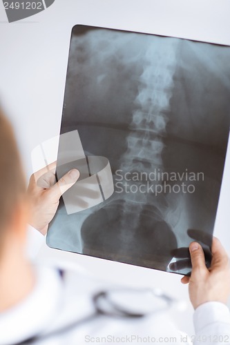 Image of doctor holding x-ray or roentgen image