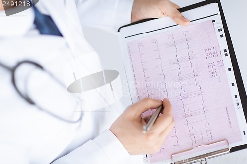 Image of male doctor hands with cardiogram