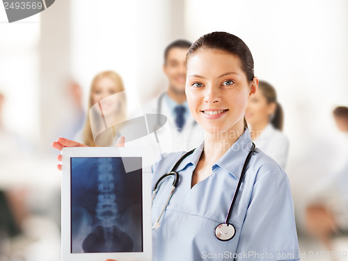 Image of female doctor with x-ray on tablet pc