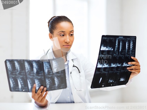 Image of african doctor looking at x-rays