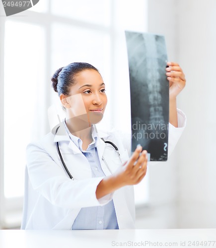 Image of african doctor looking at x-ray