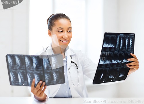 Image of african doctor looking at x-ray