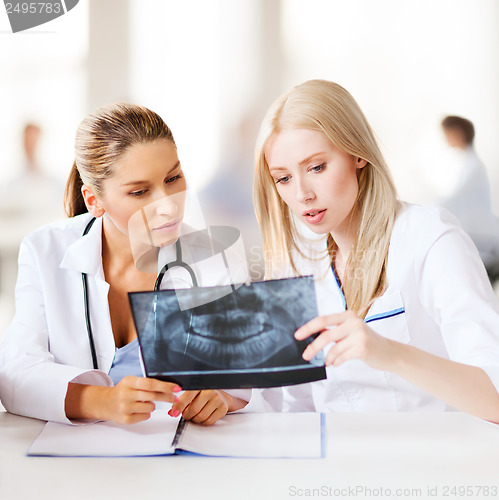 Image of group of doctors looking at x-ray