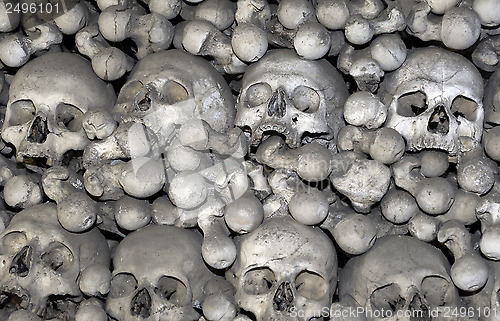 Image of Human bones.