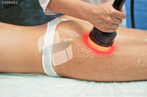 Image of procedure
