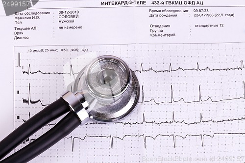 Image of stethoscope on ECG