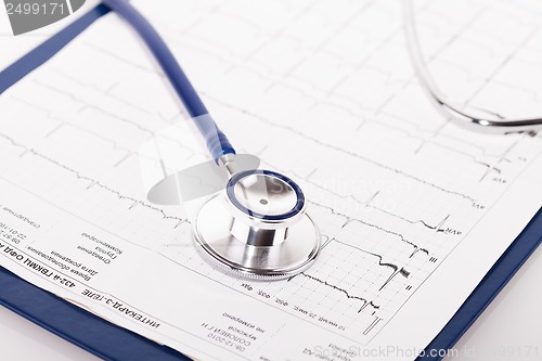 Image of stethoscope on ECG