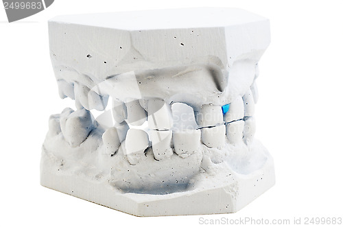 Image of detailed macro of teeth molding 