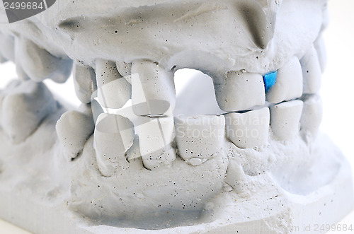 Image of detailed macro of teeth molding 