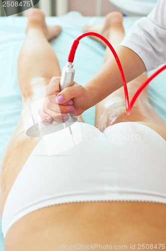 Image of procedure