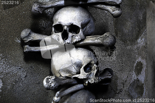 Image of Human bones.