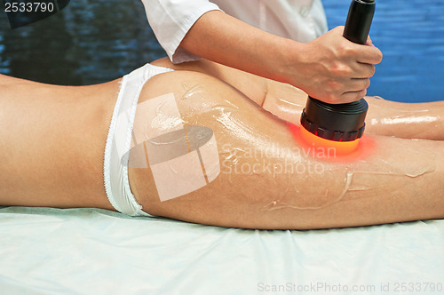 Image of procedure