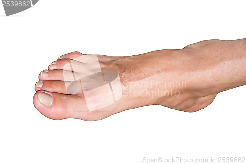 Image of foot