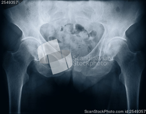 Image of x-ray with bolt