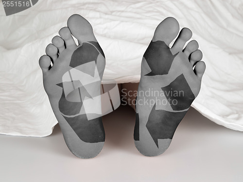 Image of Dead body