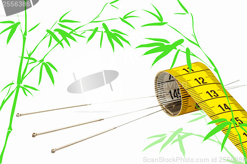 Image of acupuncture for weight loss