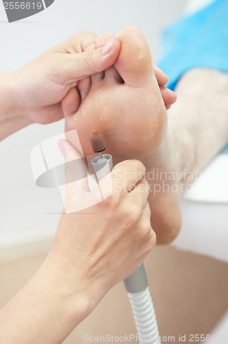 Image of pedicure