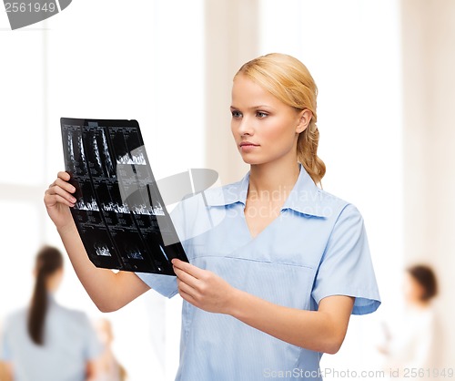 Image of serious doctor or nurse looking at x-ray
