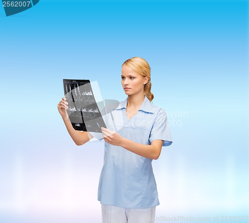 Image of serious doctor or nurse looking at x-ray