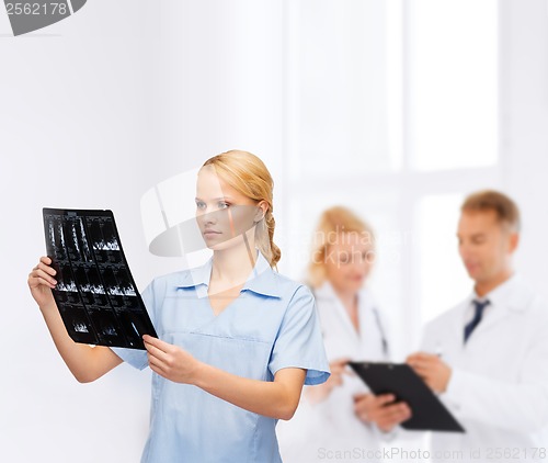 Image of serious doctor or nurse looking at x-ray