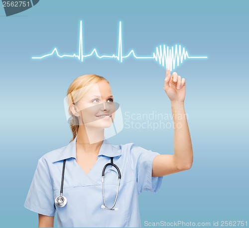 Image of smiling doctor or nurse pointing to cardiogram