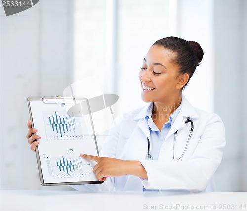 Image of doctor pointing to cardiogram