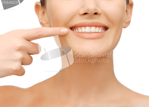 Image of beautiful woman pointing to teeth