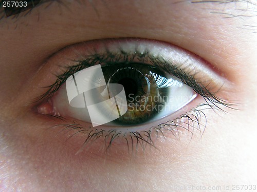 Image of Eye