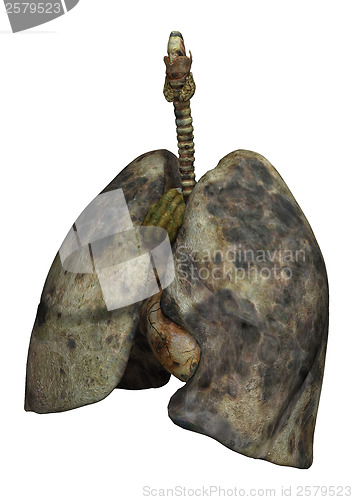 Image of Lungs of Female Smokers