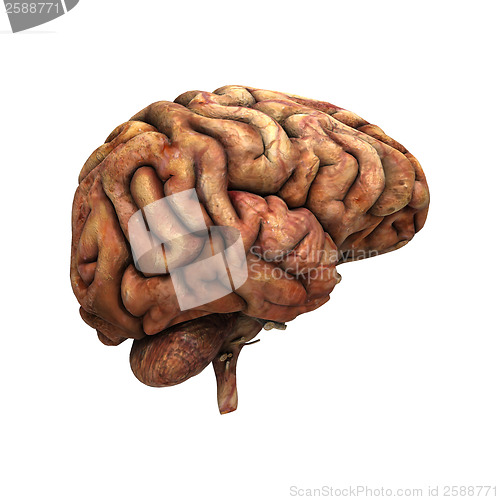 Image of Sick Human Brain