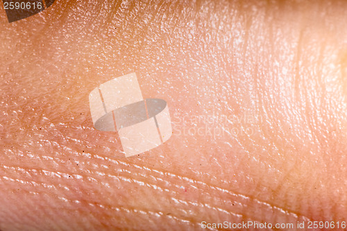 Image of Close up human skin. Macro epidermis 